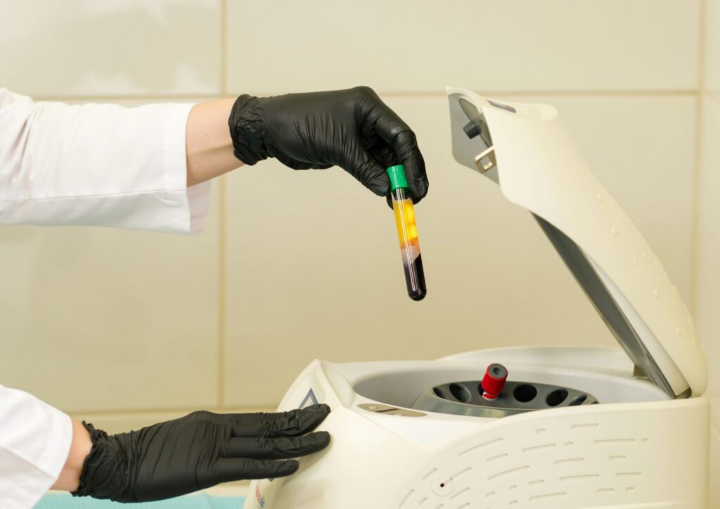 PRP and iPRF Plasma Therapy